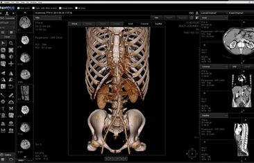 디스투윌, ‘모바일 3D 의료영상 뷰어’ 조만간 상용화
