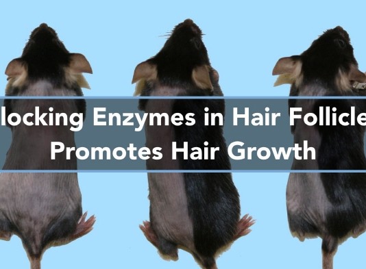 ‘굿바이 대머리’…드럭 리포지셔닝 기법으로 머리카락 재생 약에 도전