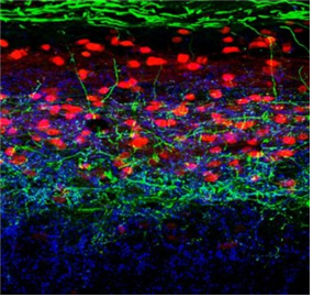 ‘근질근질’, 가려움을 긁게 하는 메커니즘 밝혀지다