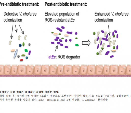 항생제 치료 중 발생하는 장질환 치료 방법 찾아