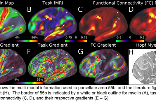인류 역사상 가장 자세한 뇌지도 작성… 대뇌피질 180개 영역