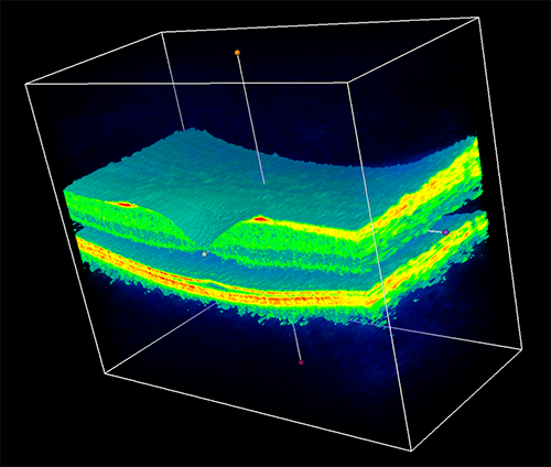 구글 딥마인드, 안과 질환에 머신러닝 활용…구글 헬스전략에 인공지능 적용
