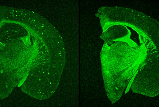 KIST, 알츠하이머 신약물질 ‘아밀로이드 베타와 타우’ 모두 잡아