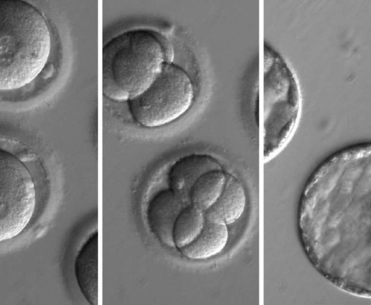 맞춤형 아기?…유전자가위, 인간배아 질병유전자 교정 성공