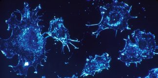 종양 줄기세포 탐지기 개발 성공