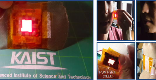 국내 연구진, 빛으로 상처 치료한다