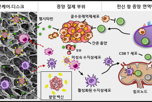 체내 이식 약물전달 플랫폼 이용 항암면역치료 향상
