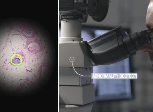 구글, 암 탐지 인공지능 ‘AR 현미경’ 개발