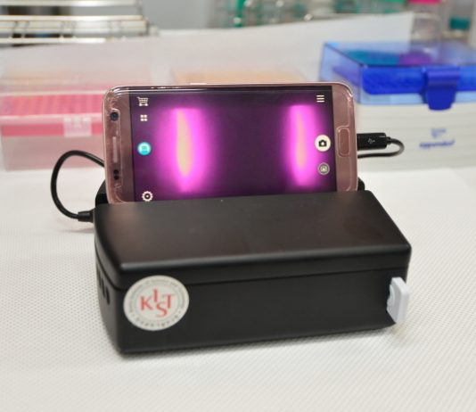 조류인플루엔자 진단 키트 개발