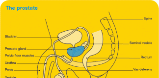 자위, 암 위험 줄인다