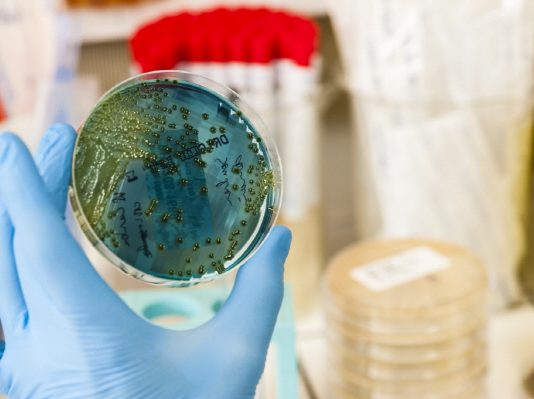 슈퍼 바이러스 잡고 내성없는 새로운 항생제 개발