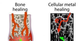 파손된 금속, 인간 뼈처럼 복구하는 기술 개발