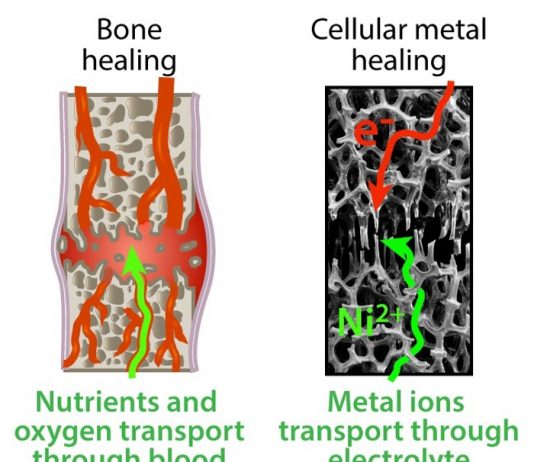 파손된 금속, 인간 뼈처럼 복구하는 기술 개발