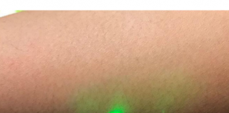 “레이저 초음파 검사 기술 나온다”