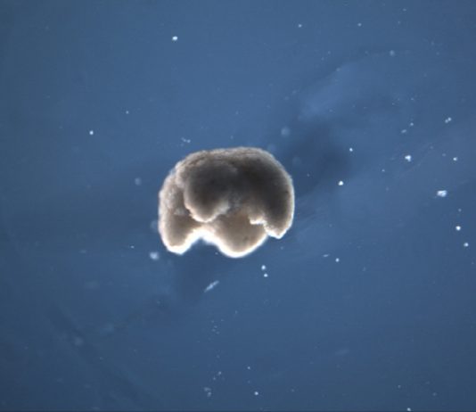 세계 첫 개구리 줄기세포로 살아있는 로봇 개발