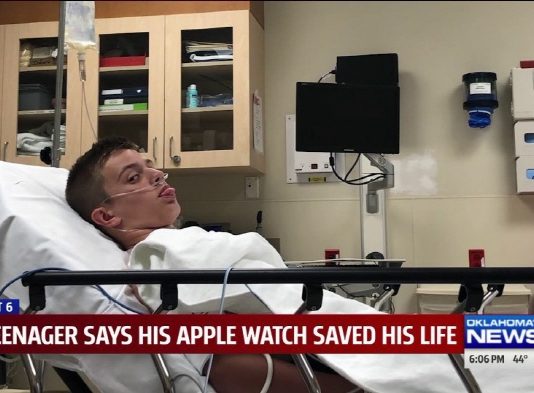 애플워치, “10대 소년 심장이상 감지 목숨 살려”