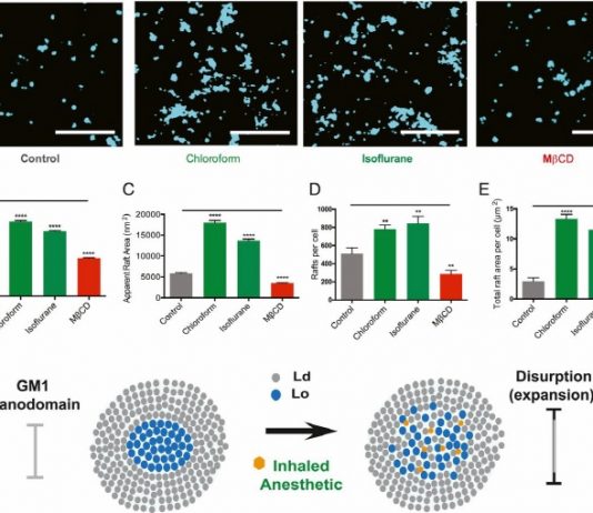 “왜 전신마취는 의식을 잃는지 메카니즘 밝혀져”