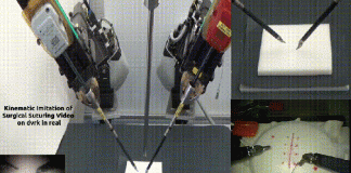 영상보고 외과수술 마스터한 AI 로봇 등장