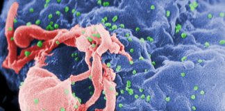 사상 첫 줄기세포로 여성 HIV 환자 치료 성공