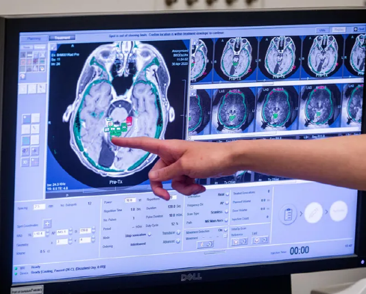 초음파 빔으로 “암 치료제 뇌에 보낸다”