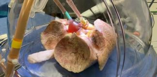 혈액형 관계없이 ‘유니버설 장기’ 실증 실험 성공