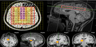“머리 열 받아” 사실이었다…뇌 온도 40도 넘어