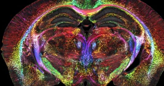 MRI 해상도 기존 6400만배 높인 기술 등장