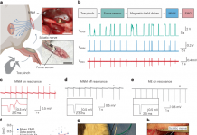 끊어진 신경 다시 연결하는 물질 개발 성공