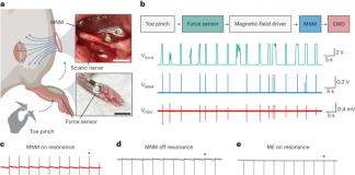 끊어진 신경 다시 연결하는 물질 개발 성공