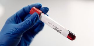 FDA, 혈액으로 47가지 암 유전자 진단 도구 첫 시판 승인