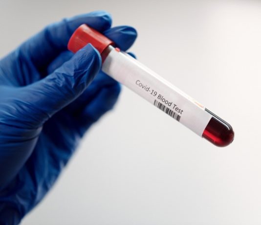 FDA, 혈액으로 47가지 암 유전자 진단 도구 첫 시판 승인