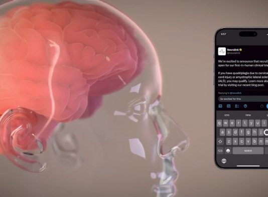 뉴럴링크 ‘텔레파시’, 첫 인간 대상 임상시험 성공