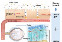 장내 세균이 시력 상실을 유발…”항생제로 막을 수 있다”