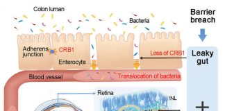 장내 세균이 시력 상실을 유발…”항생제로 막을 수 있다”