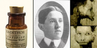 과학적 무지가 가져온 치명적 결과…“라듐 음료와 라듐 온천”