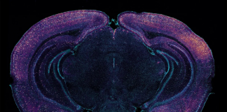 ‘깜빡’이는 40Hz 소리와 빛이 ‘알츠하이머’ 치료