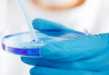 젊은층 대장암 관련 장내 세균 종류 파악