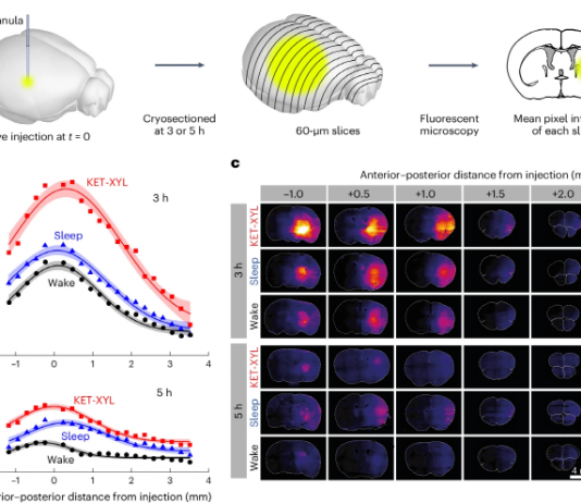 수면 중에 오히려 뇌 청소율 감소